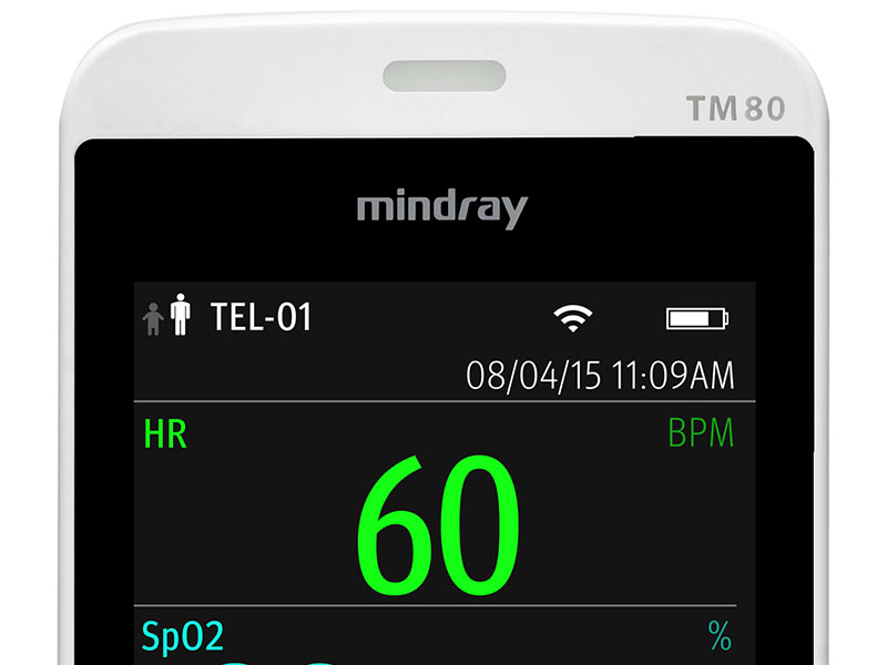 MINDRAY TM80