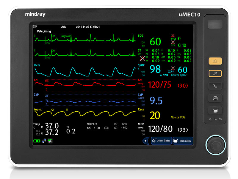 MINDRAY uMEC