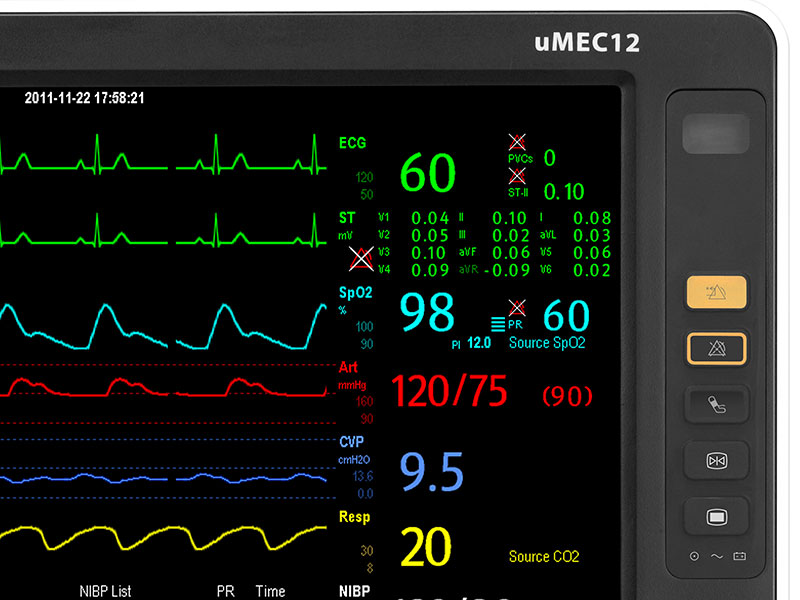 MINDRAY uMEC